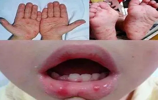 1634630523915325.jpg 640.webp (7).jpg