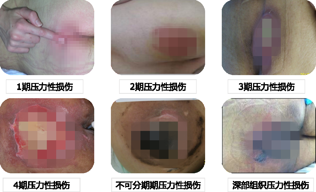 图片3_副本.png