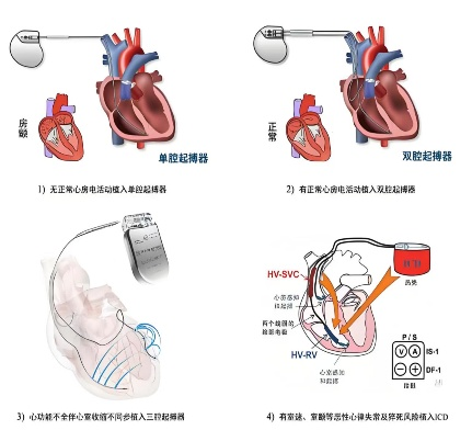 1787109503264224.png 微信图片_2026-08-19_111833_022.png